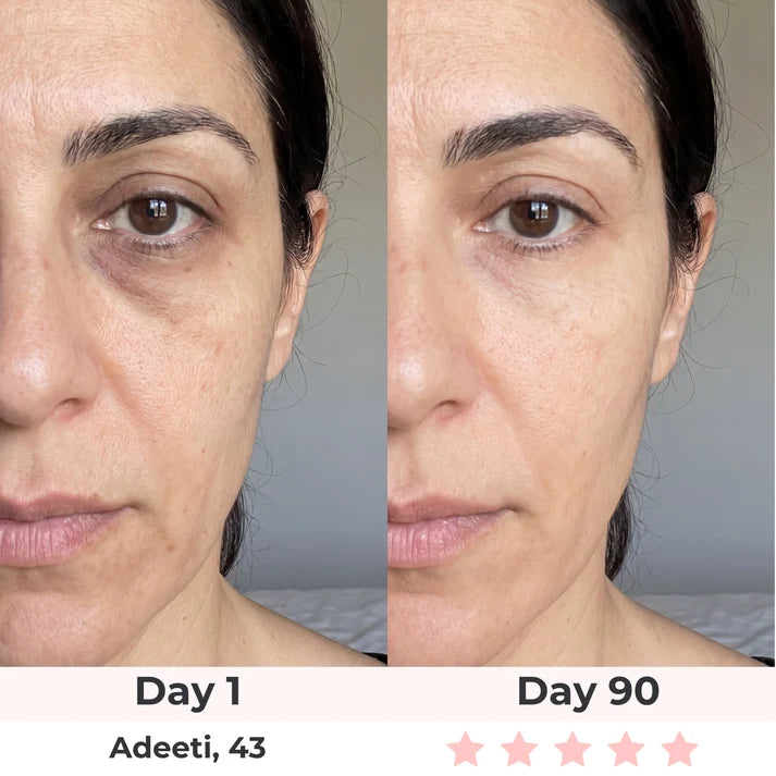 Solis — Red Light Under-Eye Glasses