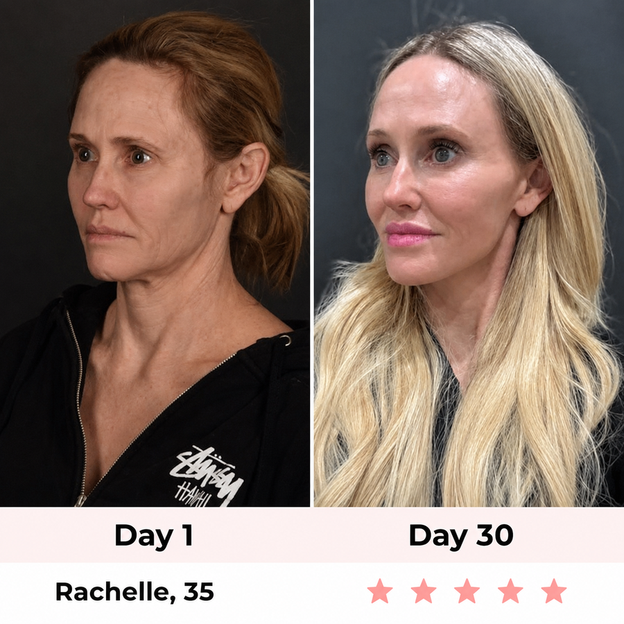 Vela — 7 in 1 Face & Neck Device